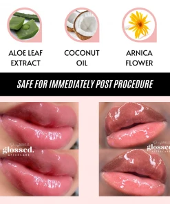 Shay Danielle Glossed Aftercare - 25 Pack After Care & Removal