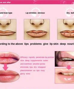 HYVE Beauty Crystal Gold Collagen Hydrating - Lip Mask - 5 Pack