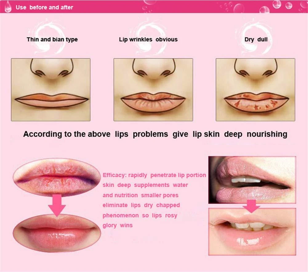 HYVE Beauty Crystal Gold Collagen Hydrating - Lip Mask - 5 Pack